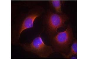 Image no. 3 for anti-Cyclin-Dependent Kinase 6 (CDK6) (pTyr13) antibody (ABIN401596) (CDK6 Antikörper  (pTyr13))
