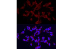 Immunofluorescence (IF) image for anti-Transient Receptor Potential Cation Channel, Subfamily C, Member 5 (TRPC5) (AA 764-973) antibody (ABIN6149578)