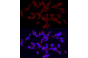 Immunofluorescence analysis of SH-SY5Y cells using TRPC5 Rabbit pAb (ABIN6128835, ABIN6149578, ABIN6149579 and ABIN6214219) at dilution of 1:150 (40x lens). (TRPC5 Antikörper  (AA 764-973))