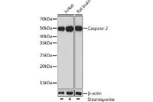 Western blot analysis of extracts of various cell lines using Caspase-2 Polyclonal Antibody at dilution of 1:1000. (Caspase 2 Antikörper)