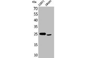 Western Blot analysis of 22RV-1 SW480 cells using SSX Polyclonal Antibody (SSX1 Antikörper  (C-Term))