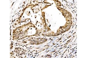 IHC analysis of SPHK1 using anti-SPHK1 antibody (ABIN7600168). (SPHK1 Antikörper  (AA 16-267))