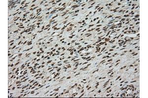 Immunohistochemical staining of paraffin-embedded colon tissue using anti-TYRO3mouse monoclonal antibody. (TYRO3 Antikörper)