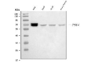 Western blot analysis of p66 alpha using anti-p66 alpha antibody (ABIN7605833).