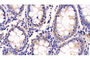 Detection of IGF1 in Human Colon Tissue using Monoclonal Antibody to Insulin Like Growth Factor 1 (IGF1) (IGF1 Antikörper  (AA 49-118))