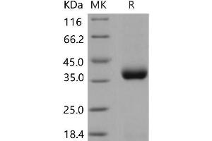 Western Blotting (WB) image for C-Type Lectin Domain Family 10, Member A (CLEC10A) protein (His tag) (ABIN7194474)