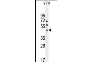 LACE1 Antibody (N-term) (ABIN654572 and ABIN2844276) western blot analysis in Y79 cell line lysates (35 μg/lane). (LACE1 Antikörper  (N-Term))