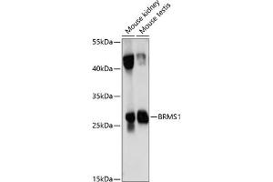 Western blot analysis of extracts of various cell lines, using BRMS1 antibody (ABIN7265929) at 1:1000 dilution. (BRMS1 Antikörper  (AA 90-210))