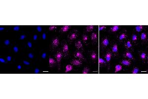 Immunocytochemical staining of H9c2 cells with RAB7A antibody (ABIN7800103), 1:1,000).