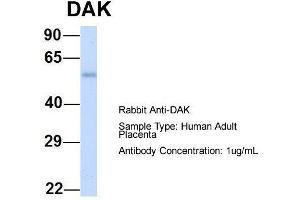 Host: Rabbit  Target Name: DAK  Sample Tissue: Human Adult Placenta  Antibody Dilution: 1. (DAK Antikörper  (N-Term))