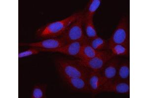 IF analysis of RAP1GDS1 using anti-RAP1GDS1 antibody (ABIN7601725). (RAP1GDS1 Antikörper  (AA 43-607))