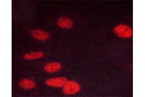 ABIN6267447 staining C6 cells by ICC/IF. (CDK1 Antikörper  (pThr14))