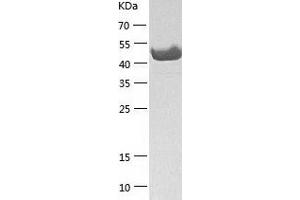 Western Blotting (WB) image for B-Cell Linker (BLNK) (AA 1-456) protein (His tag) (ABIN7288094) (B-Cell Linker Protein (BLNK) (AA 1-456) (His tag))