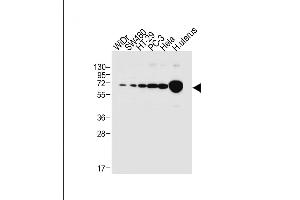All lanes : Anti-NOX1 Antibody (Center) at 1:1000 dilution Lane 1: WiDr whole cell lysate Lane 2: S whole cell lysate Lane 3: HT-29 whole cell lysate Lane 4: PC-3 whole cell lysate Lane 5: Hela whole cell lysate Lane 6: human uterus tissue lysate Lysates/proteins at 20 μg per lane. (NOX1 Antikörper  (AA 243-271))