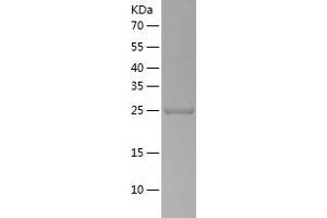 Western Blotting (WB) image for Ubiquitin Specific Peptidase 33 (USP33) (AA 71-303) protein (His tag) (ABIN7125594) (USP33 Protein (AA 71-303) (His tag))