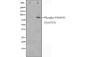 Western blot analysis of VEGFR1 phosphorylation expression in UV treated HeLa whole cell lysates,The lane on the left is treated with the antigen-specific peptide.