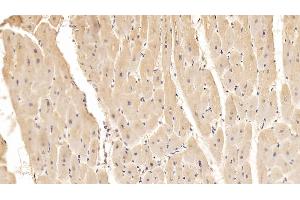 Detection of ADPN in Porcine Cardiac Muscle Tissue using Monoclonal Antibody to Adiponectin (ADPN) (ADIPOQ Antikörper  (AA 18-243))