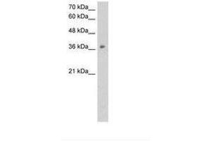 Image no. 2 for anti-Ornithine Carbamoyltransferase (OTC) (N-Term) antibody (ABIN203390) (OTC Antikörper  (N-Term))