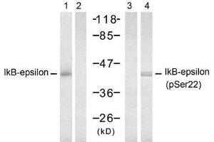 Western blot analysis of extract from 293 cells, untreated or treated with TNF-α (20ng/ml, 15min), using IkB-ε (Ab-22) antibody (E021296, Lane 1 and 2) and IkB-ε (Phospho-Ser22) antibody (E011213, Lane 3 and 4). (NFKBIE Antikörper  (pSer22))