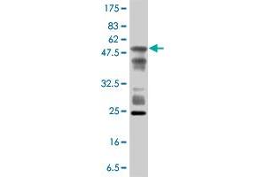 Western Blotting (WB) image for anti-Acidic (Leucine-Rich) Nuclear phosphoprotein 32 Family, Member A (ANP32A) (AA 1-249) antibody (ABIN563548)
