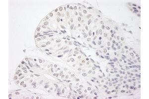 Immunohistochemistry (IHC) image for anti-Lysine (K)-Specific Demethylase 5A (KDM5A) (AA 1640-1690) antibody (ABIN7448612) (KDM5A Antikörper  (AA 1640-1690))