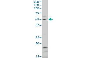 ZNF83 polyclonal antibody (A01), Lot # 051115JC01. (ZNF83 Antikörper  (AA 1-111))