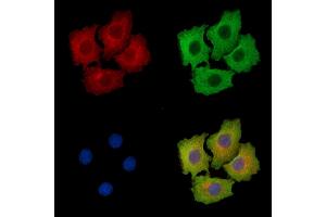 ABIN7095914 and ABIN7099976 staining HepG2 cells by IF/ICC. (CCSER1 Antikörper)
