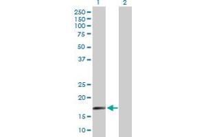 Western Blot analysis of SAP18 expression in transfected 293T cell line by SAP18 MaxPab polyclonal antibody. (SAP18 Antikörper  (AA 1-153))