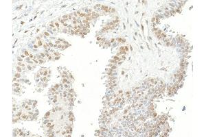 Immunohistochemistry (IHC) image for anti-Ubiquitin Specific Peptidase 7 (Herpes Virus-Associated) (USP7) (AA 1-50) antibody (ABIN7453547) (USP7 Antikörper  (AA 1-50))