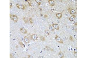 Immunohistochemistry of paraffin-embedded Mouse brain using TMOD3 Polyclonal Antibody at dilution of 1:100 (40x lens). (TMOD3 Antikörper)