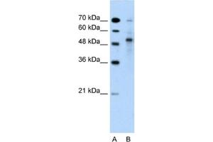 Western Blotting (WB) image for anti-Tripartite Motif Containing 59 (TRIM59) antibody (ABIN2462701) (TRIM59 Antikörper)