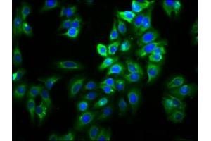 Immunofluorescence staining of HepG2 cells with ABIN7170215 at 1:66, counter-stained with DAPI. (Slc26a9 Antikörper  (AA 551-660))