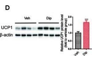 Diphyllin enhances brown/beige thermogenesis and reduces adipocyte size in DIO mice. (UCP1 Antikörper  (AA 1-307))