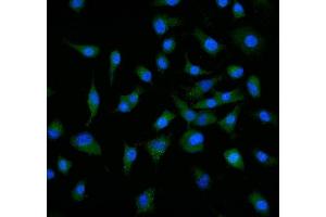 IF analysis of Neuropilin 1 using anti-Neuropilin 1 antibody (ABIN7601920). (Neuropilin 1 Antikörper  (AA 504-827))