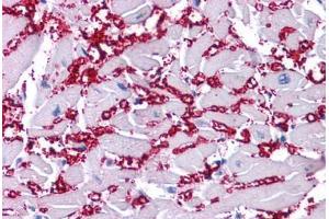 Human Heart: Formalin-Fixed, Paraffin-Embedded (FFPE)