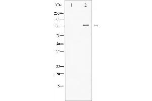 Western Blotting (WB) image for anti-Nuclear Factor of kappa Light Polypeptide Gene Enhancer in B-Cells 1 (NFKB1) (pSer927) antibody (ABIN6256451)