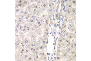 Immunohistochemistry of paraffin-embedded rat liver using DTX2 antibody (ABIN6127799, ABIN6139853, ABIN6139854 and ABIN6223266) at dilution of 1:100 (40x lens). (DTX2 Antikörper  (AA 1-280))