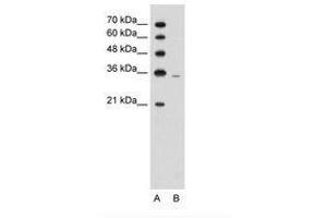 Image no. 1 for anti-phosphoribosyl Pyrophosphate Synthetase 2 (PRPS2) (AA 157-206) antibody (ABIN203392) (PRPS2 Antikörper  (AA 157-206))