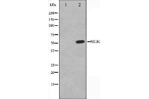 Western blot analysis of SGK expression in Jurkat whole cell lysates,The lane on the left is treated with the antigen-specific peptide. (SGK1 Antikörper  (C-Term))
