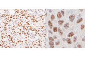 Immunohistochemistry (IHC) image for anti-Heterogeneous Nuclear Ribonucleoprotein U (Scaffold Attachment Factor A) (HNRNPU) (AA 450-500) antibody (ABIN7453827)