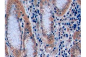 Immunohistochemistry (IHC) image for anti-CD7 (CD7) (AA 26-134) antibody (ABIN7444421)