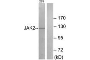 Western blot analysis of extracts from 293 cells, treated with etoposide 25uM 24h, using JAK2 (Ab-570) Antibody. (JAK2 Antikörper  (AA 541-590))