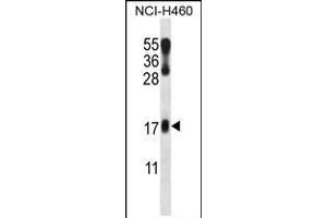 LMO2 Antibody (N-term) (ABIN658023 and ABIN2846961) western blot analysis in NCI- cell line lysates (35 μg/lane). (LMO2 Antikörper  (N-Term))