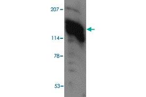 Western blot analysis of AMBRA1 in human heart tissue lysate with AMBRA1 polyclonal antibody  at (A) 0.