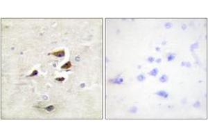 Immunohistochemistry analysis of paraffin-embedded human brain tissue, using CaMK2 alpha/beta/delta (Ab-305) Antibody. (CaMK2 alpha/beta/delta Antikörper  (AA 271-320))