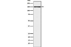 Western blot analysis of CLSTN1 expression in 293T cell lysate. (Rekombinanter Calsyntenin 1 Antikörper)