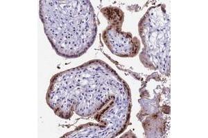 Immunohistochemical staining of human placenta with CC2D2A polyclonal antibody  shows strong nuclear and cytoplasmic positivity in trophoblastic cells.