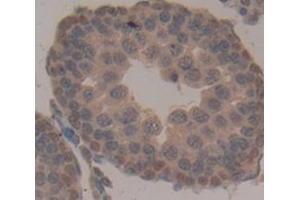 Used in DAB staining on fromalin fixed paraffin- embedded Kidney tissue (TPSB2 Antikörper  (AA 30-274))