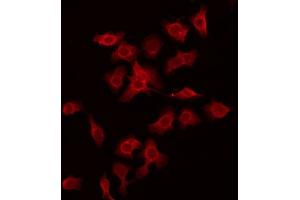 ABIN6275981 staining Hela by IF/ICC. (CSRL1 Antikörper)