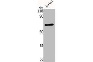 Western Blot analysis of Jurkat cells using Kv3. (Kv3.4 Antikörper)